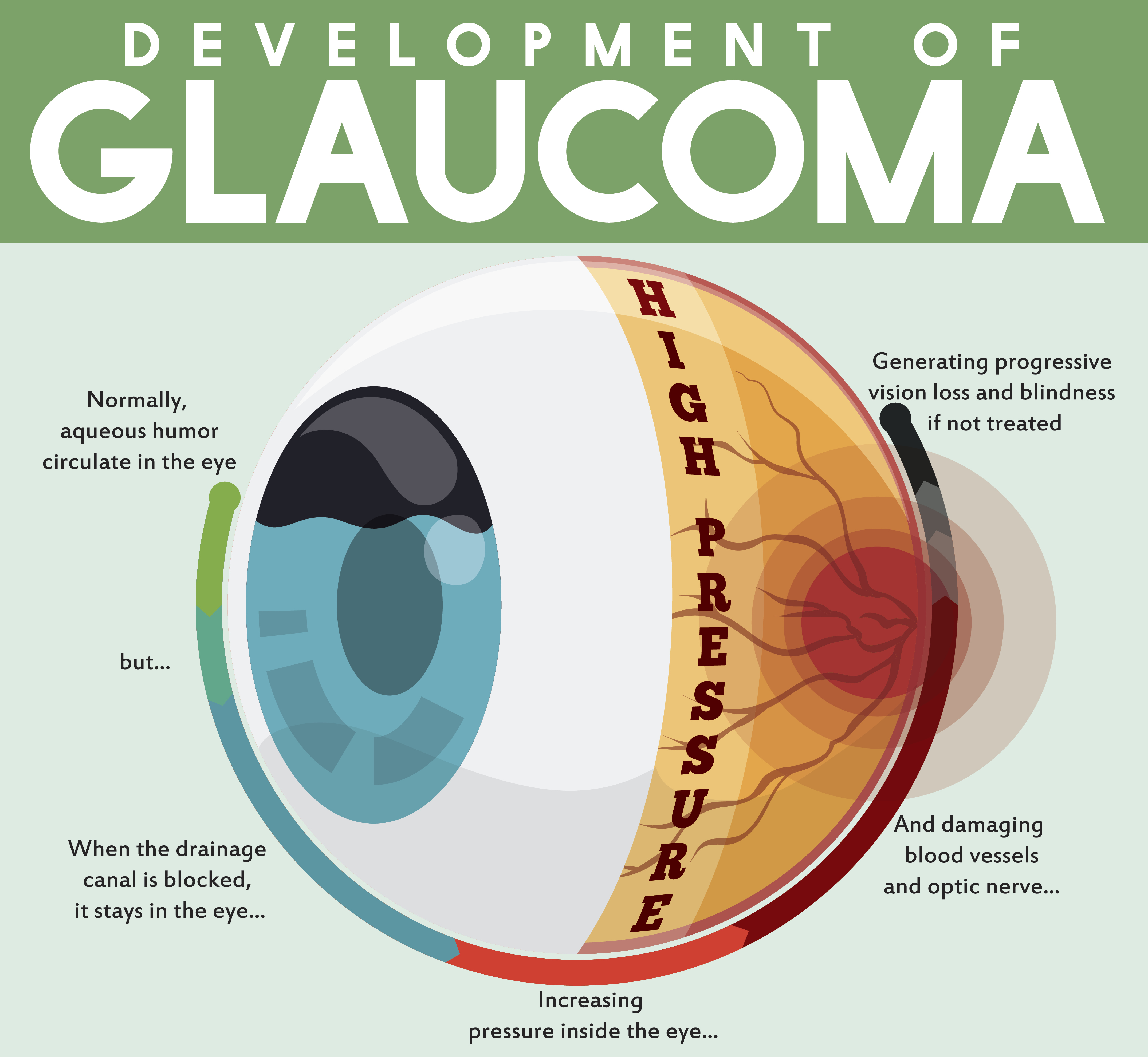 Professional diploma in glaucoma